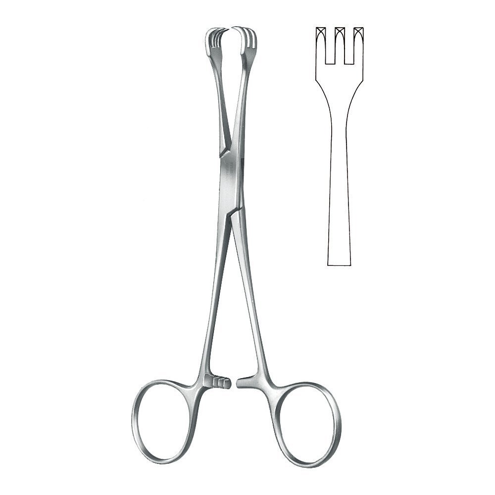 Tracheotomy