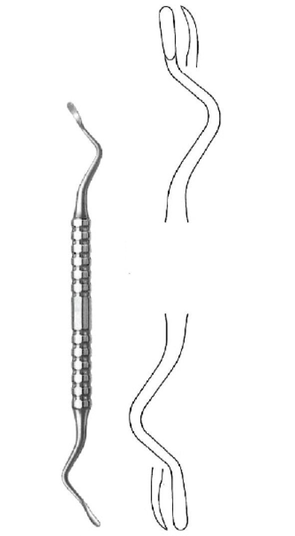 Oral Maxillo-Facial Surgery